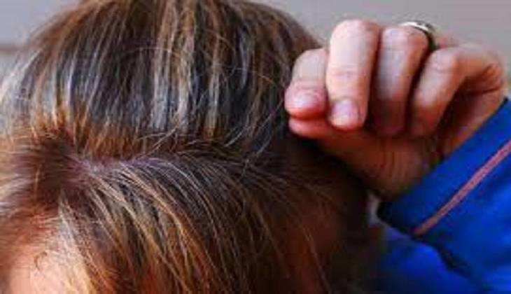 Hair Care Tips: बारिश में  सिर पर खुजली होने की वजह से आता है ऑयली डैंड्रफ, इन लक्षणों से पहचान कर रोकें हेयरफॉल