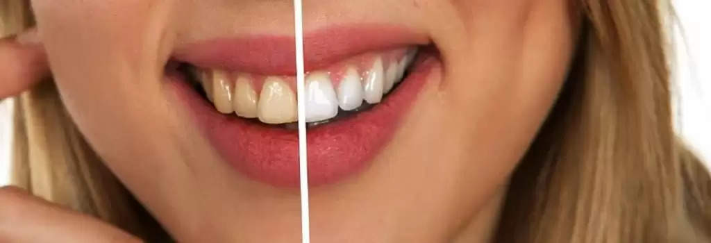 Dental Care: घर बैठे सिर्फ 10 रूपये में हटाएं दांतों का पीलापन फिर खुलकर हंसें आप