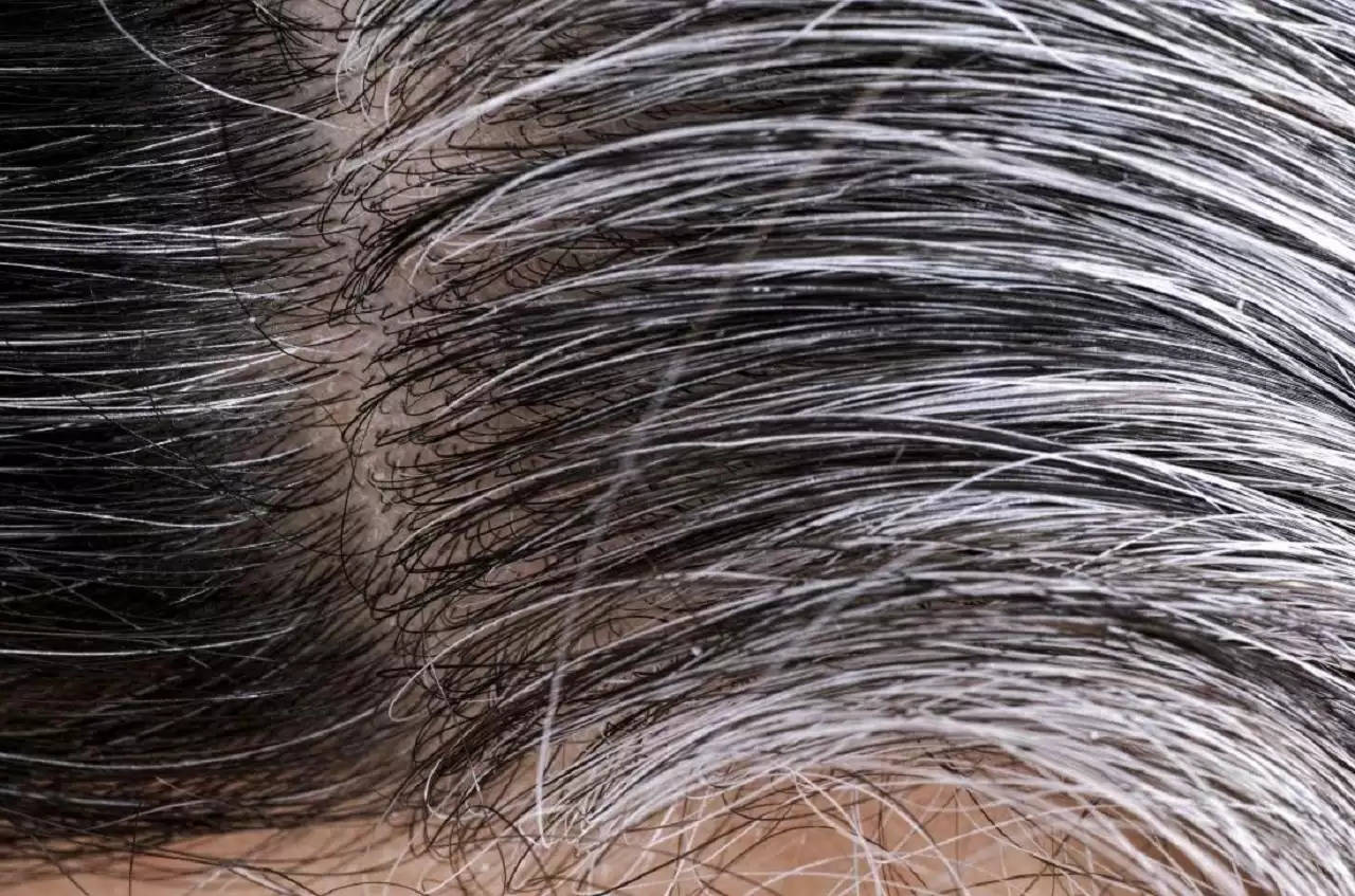 Hair Care Tips: इन 4 तरीकों से इस्तेमाल करें मेथी के दाने, मिलेगा सफेद बालों से छुटकारा