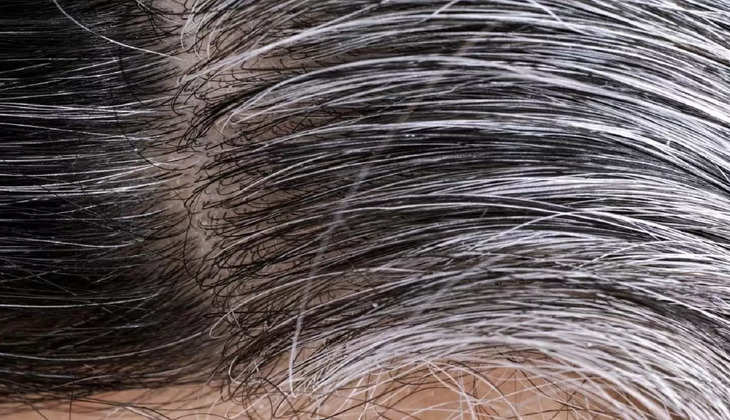 Hair Care Tips: इन 3 कारणों से होते हैं सफेद बाल! टेंशन छोड़िए अपनाएं ये उपाय दोबारा लगने लगेंगे जवान