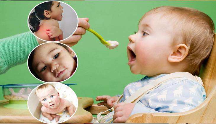 Food Allergy In Children: बच्चों में फूड एलर्जी को कैसे पहचानें? इन फूड टिप्स से ठीक हो जाएगी उनकी सेहत