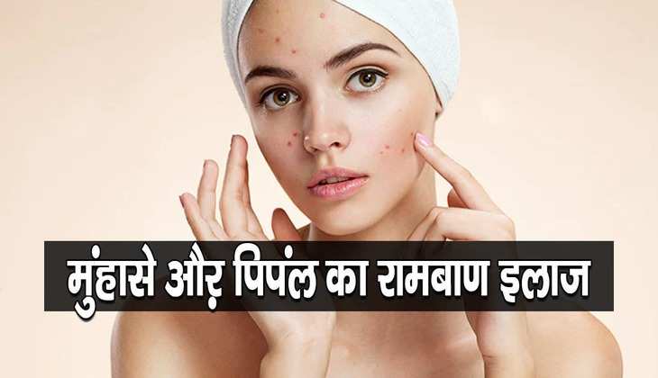 Beauty Tips: चेहरे पर विटामिन ई कैप्सूल और नारियल तेल लगाने से आएगी चमक, जानें इसके धांसू फायदे