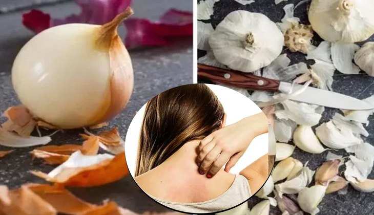 Onion and Garlic Peels: प्याज और लहसुन के छिलके हैं बहुत काम के, स्किन के इलाज से लेकर खाद बनाने तक में ऐसे करें यूज