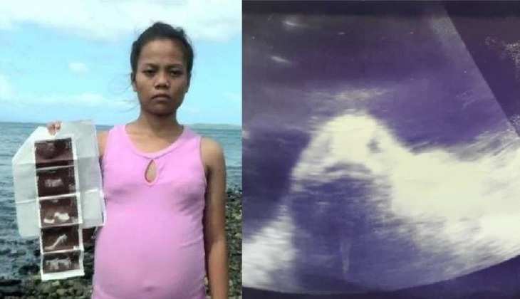 थाईलैंड: महिला के पेट में पल रही थी मछली?अल्ट्रासाउंड कराने पर सामने आया सच