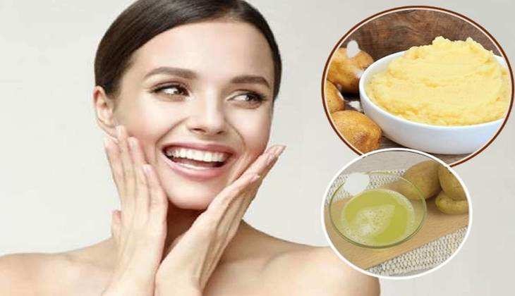 Beauty Tips: त्वचा के दाग धब्बों को झट से कर दें दूर Potato Face Pack, चांद सा निखर आएगा चेहरा