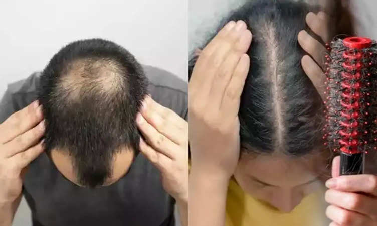 Hair Growth Tips: झड़ते बालों की वजह से नहीं हों परेशान, जानिए 10 रुपए का देसी इलाज