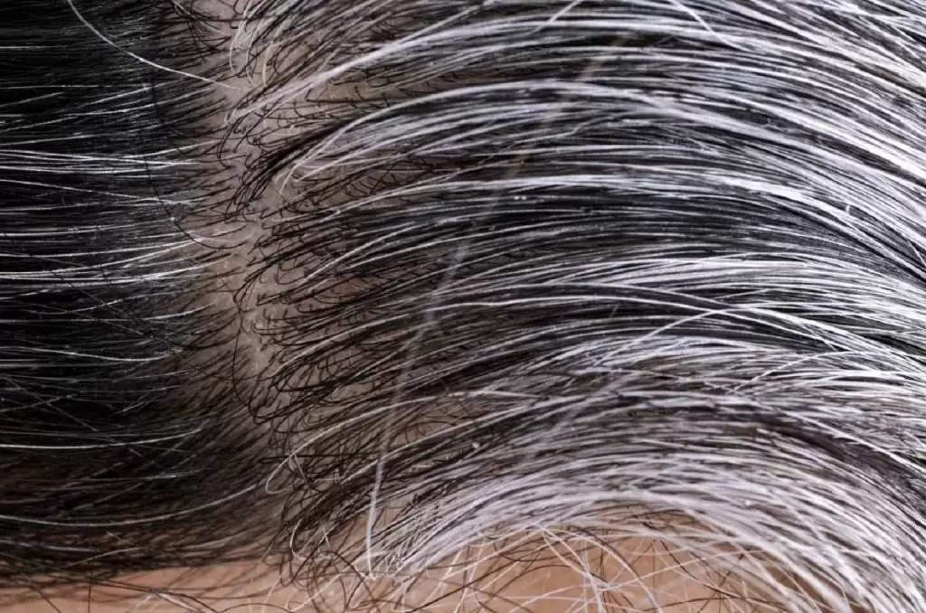 Hair care: इन चीजों का जरूर करें इस्तेमाल..30 क्या 50 की उम्र में भी नहीं आएगी बालों में सफेदी