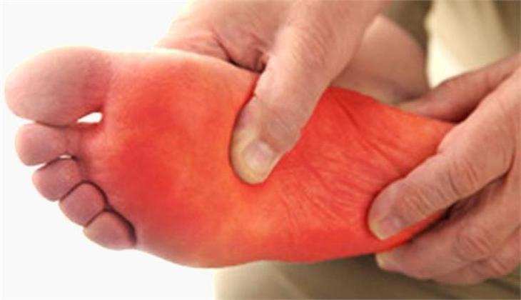 Health Alert: आपके भी पैरों में होती है जलन तो इसे ना करें इग्नोर, इन 5 खतरनाक बीमारियों का हो सकता है संकेत