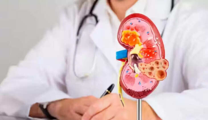 इन 7 दवाओं से किडनी को होता है नुकसान, जानिए कौन सी हैं ये