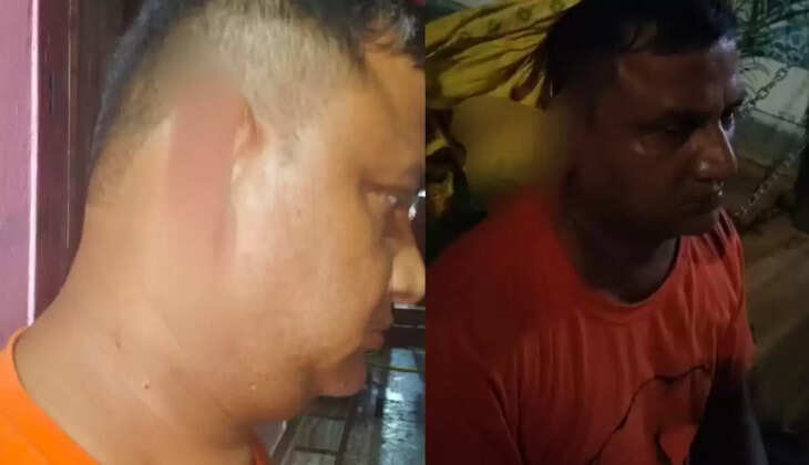 कानपुर में वैवाहिक विवाद बना खौफनाक, पत्नी ने पति का कान काटा