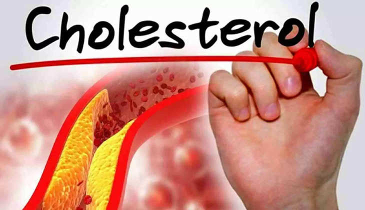 cholesterol control 