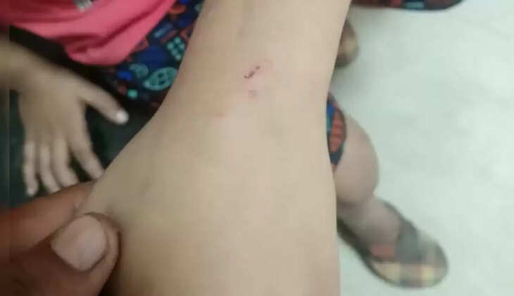 कानपुर में पड़ोसी ने मासूम को पीटा और कुत्ते से कटवाया, वजह बना एक अमरूद